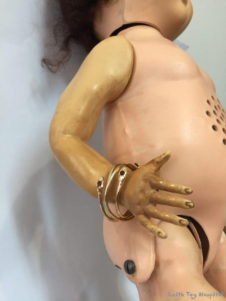 A doll with sad doll disease - one arm is shrivelled and yellowing